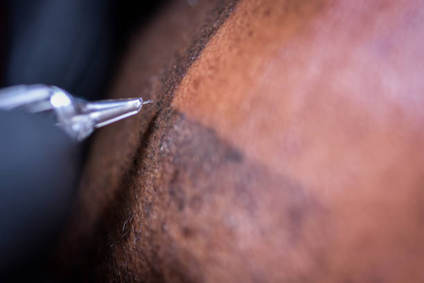 scalp micro pigmentation 